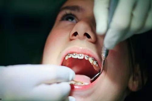 成人长蛀牙视频真实,真实视频揭示口腔健康危机